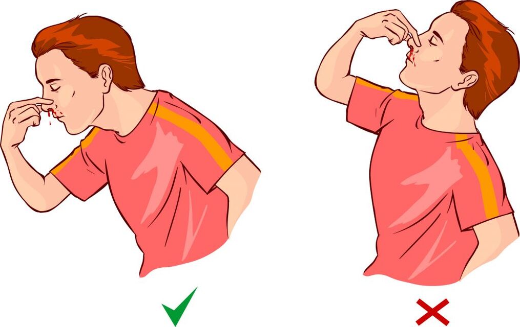 Symptoms of hypertension