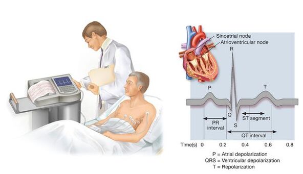 Electrocardiogram to detect hypertension and cardiovascular disease