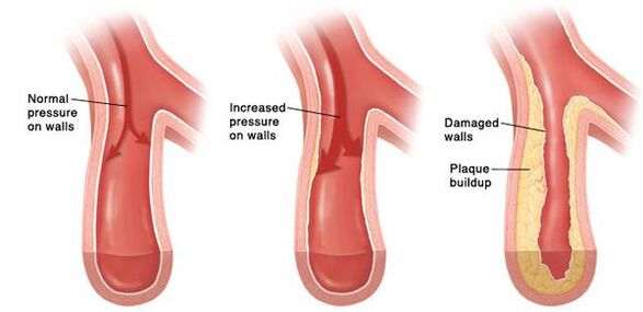 In hypertension, the patency of the vascular bed is violated